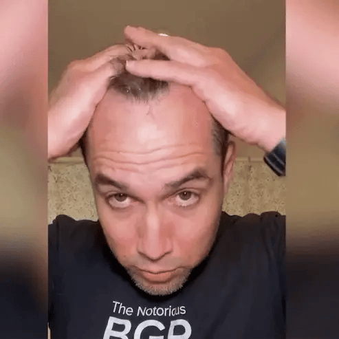 بخاخ لنمو الشعر Hair Growth Spray